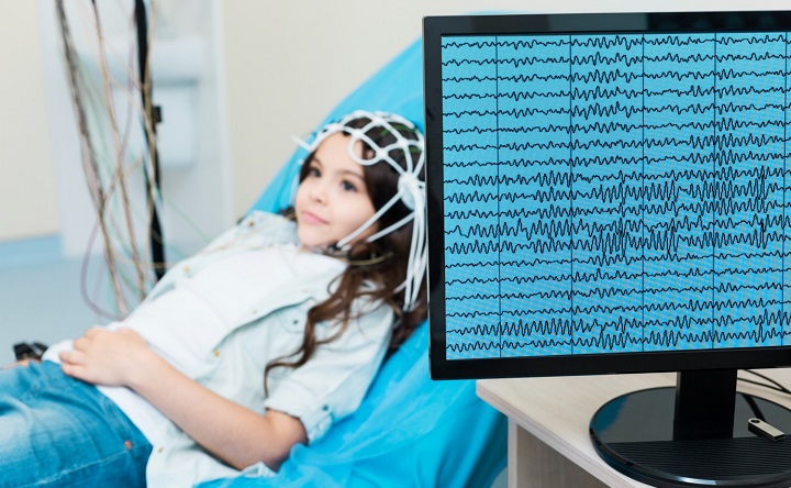 ЭЭГ-мониторинг. Фото фотобанка 123rf.com